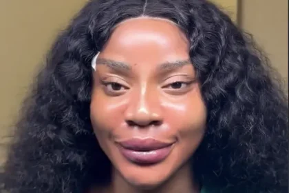 Fans react as Nollywood actress undergoes facial transformation after marriage crash, BBL